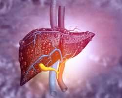 Karaciğer Yağlanması Nedir? Nasıl Tedavi Edilir?